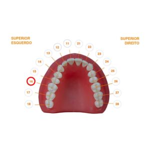 Dente 16.6 Classe I 2201 - Prodens