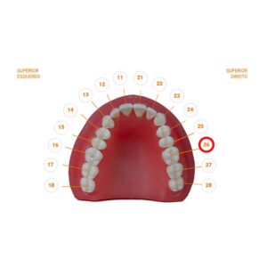 Dente 26.2 Classe I 2230 - Prodens