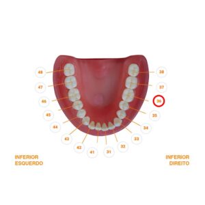 Dente 36.1 Classe I 2239 - Prodens